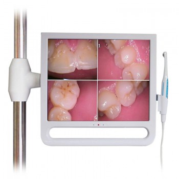 YF1700M Caméra intra-orale dentaire avec moniteur 17 pouces et support 1024*768 ...