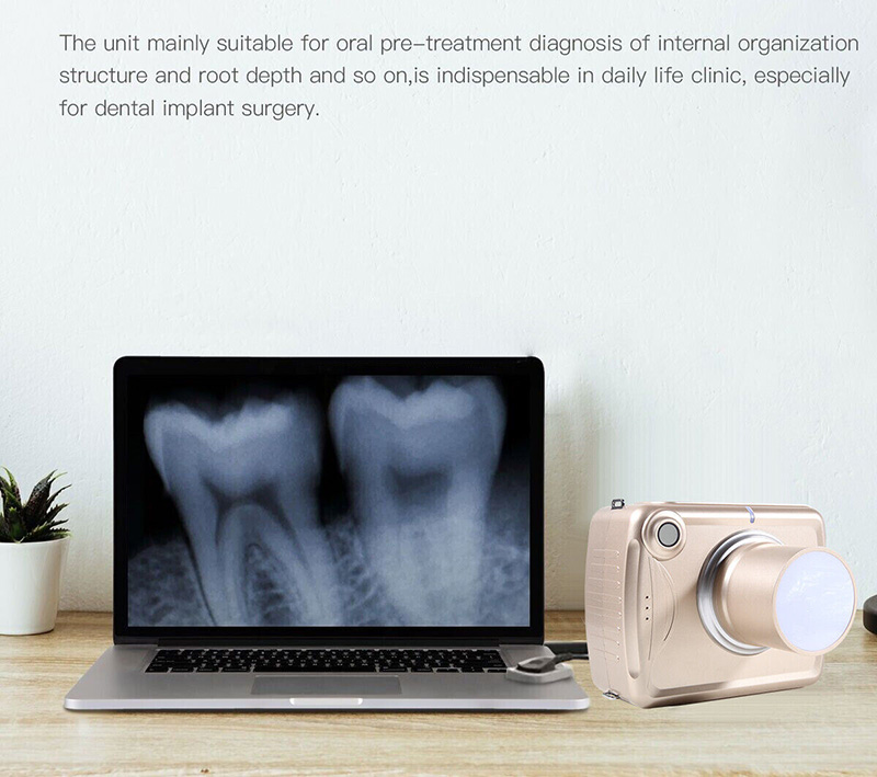 Système d'imagerie à haute fréquence pour appareil de radiographie dentaire numérique