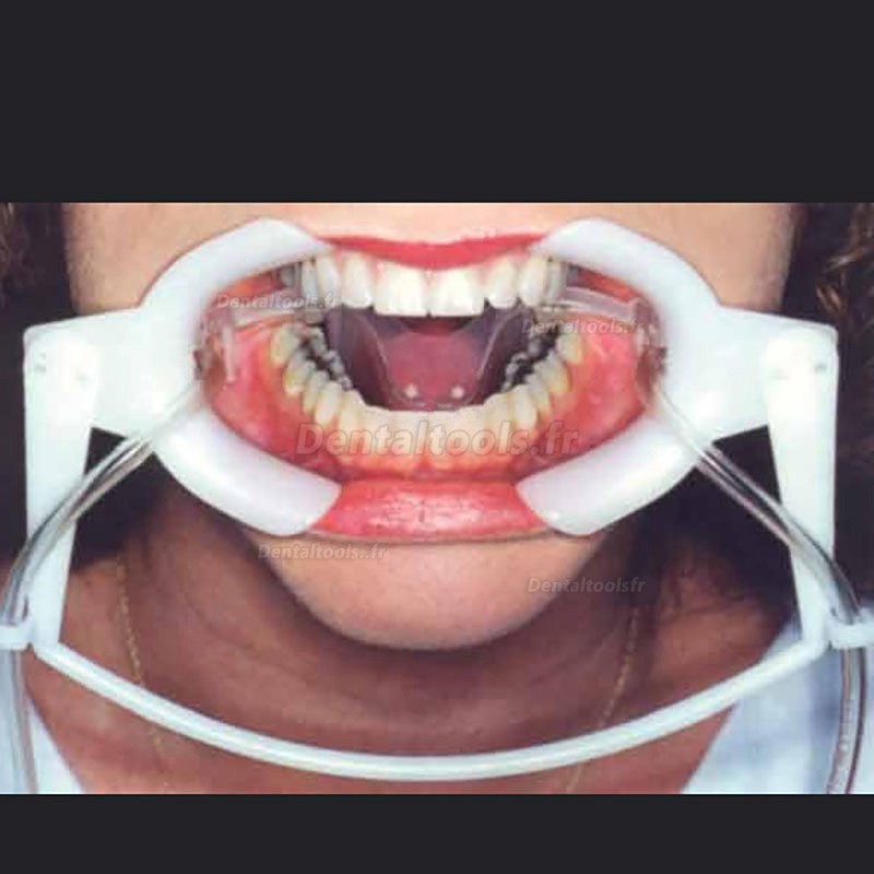 Dentalclick France, Distributeur de produits dentaires ECARTEUR BOUCHE  PLASTIQUE OPEN-EX