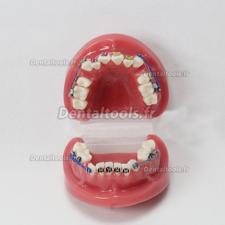 Miroir photo cristal lingual, Fourniture dentaire