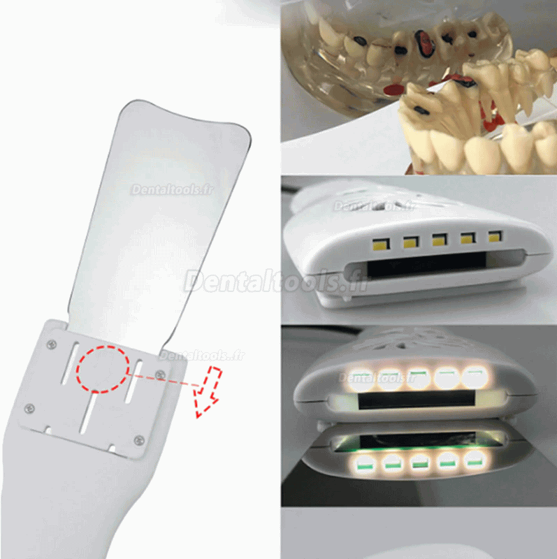Miroir automatique anti-buée dentaire pour la photographie buccale