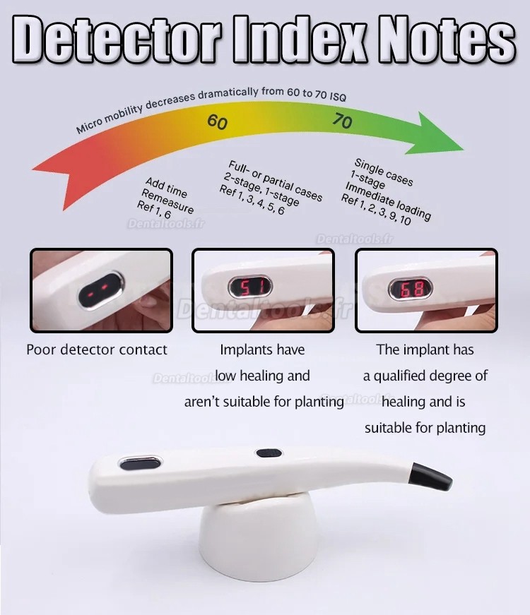 Moniteur de stabilité d'implant dentaire portable ISQ appareil de test de stabilité d'implant